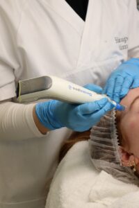 Microneedling met Dermapen voor verbetering van huidstructuur bij Dermanova Clinic