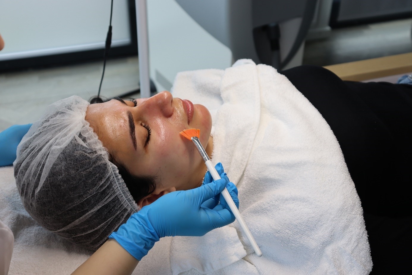 Klant ondergaat professionele peelingbehandeling bij Dermanova Clinic