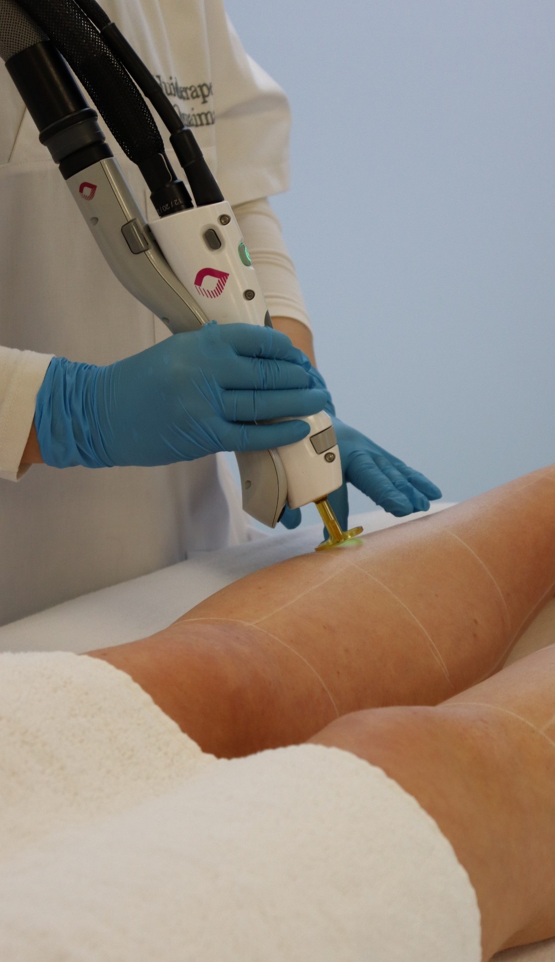 Klant ontvangt laserbehandeling met Gentle Max Pro Plus bij Dermanova Clinic