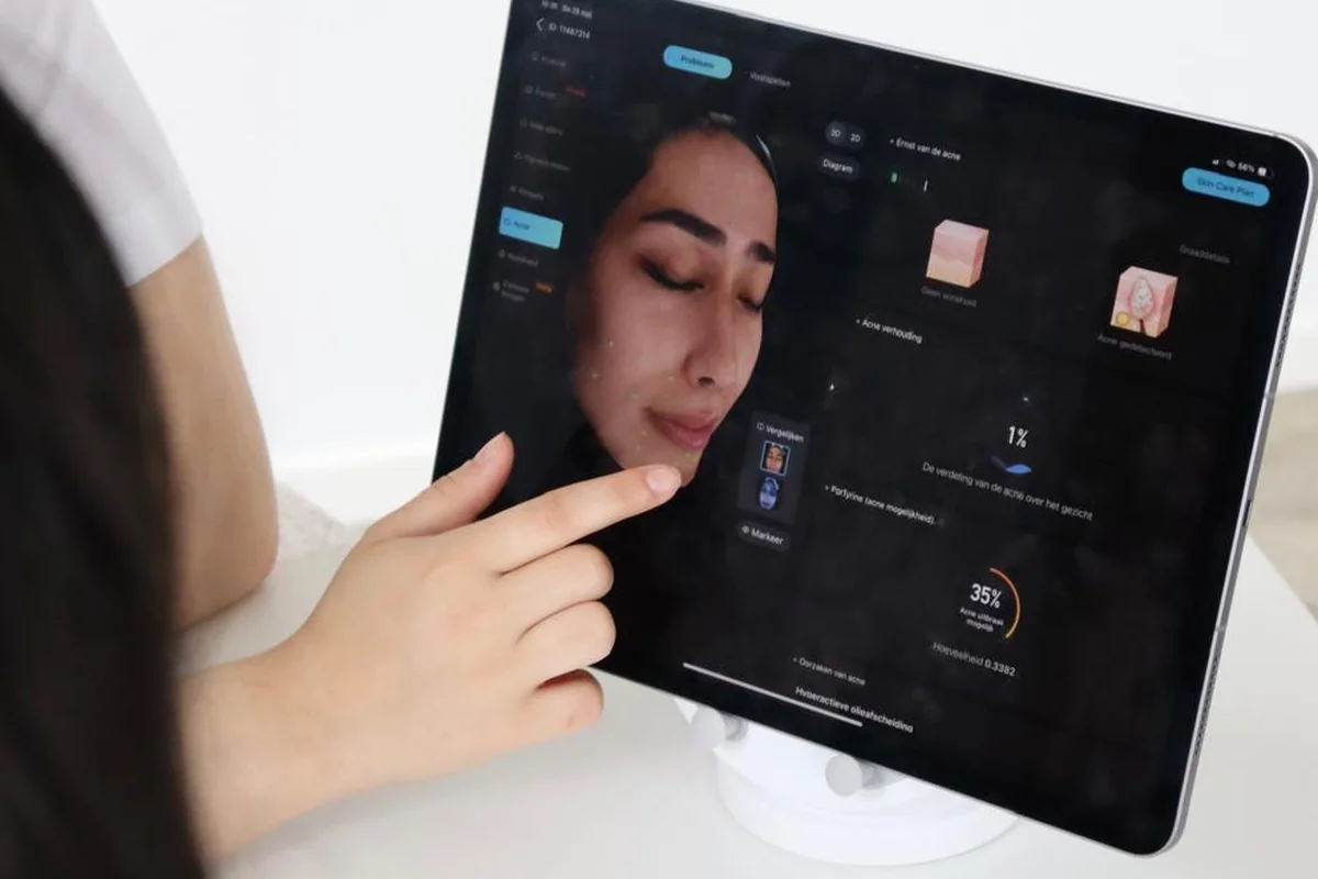 Persoonlijk behandelplan tijdens intake bij Dermanova Clinic in Den Haag